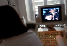 Caso Torino, ginecologo: “Possibile ‘ciclo’ anche in gravidanza”