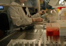 Nuova arma contro l’artrite reumatoide